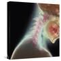 Broken Neck-Science Photo Library-Stretched Canvas