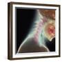 Broken Neck-Science Photo Library-Framed Premium Photographic Print