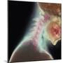 Broken Neck-Science Photo Library-Mounted Premium Photographic Print