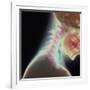 Broken Neck-Science Photo Library-Framed Photographic Print