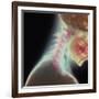 Broken Neck-Science Photo Library-Framed Photographic Print