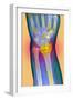 Broken Wrist, X-ray-Du Cane Medical-Framed Photographic Print