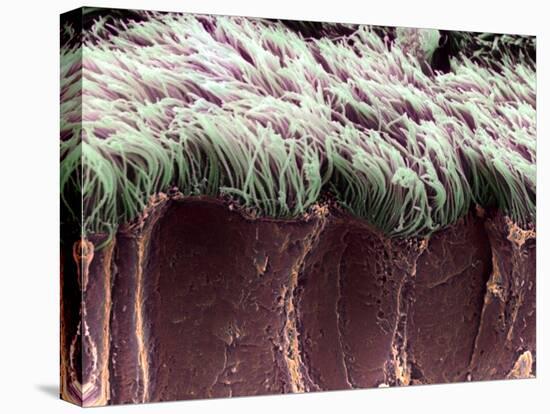 Bronchial Cilia, SEM-Steve Gschmeissner-Stretched Canvas