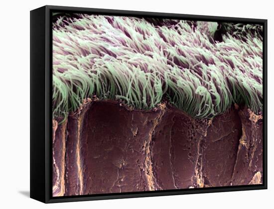 Bronchial Cilia, SEM-Steve Gschmeissner-Framed Stretched Canvas