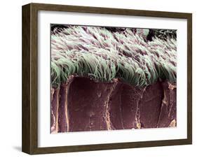 Bronchial Cilia, SEM-Steve Gschmeissner-Framed Photographic Print