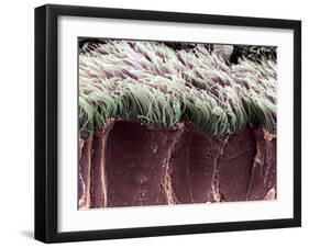 Bronchial Cilia, SEM-Steve Gschmeissner-Framed Photographic Print