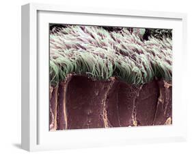 Bronchial Cilia, SEM-Steve Gschmeissner-Framed Photographic Print