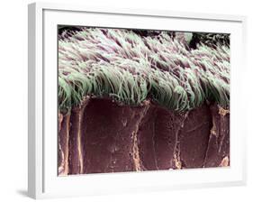 Bronchial Cilia, SEM-Steve Gschmeissner-Framed Photographic Print