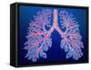 Bronchial Tree of Lungs-PASIEKA-Framed Stretched Canvas