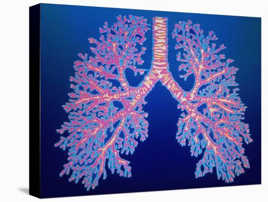 Bronchial Tree of Lungs-PASIEKA-Stretched Canvas
