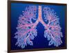 Bronchial Tree of Lungs-PASIEKA-Framed Photographic Print