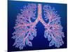 Bronchial Tree of Lungs-PASIEKA-Mounted Photographic Print