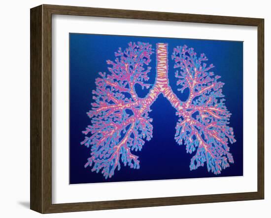 Bronchial Tree of Lungs-PASIEKA-Framed Photographic Print