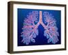 Bronchial Tree of Lungs-PASIEKA-Framed Photographic Print