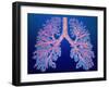 Bronchial Tree of Lungs-PASIEKA-Framed Photographic Print