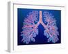 Bronchial Tree of Lungs-PASIEKA-Framed Photographic Print