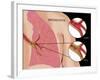 Bronchitis-Monica Schroeder-Framed Giclee Print