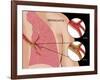 Bronchitis-Monica Schroeder-Framed Giclee Print