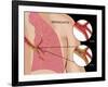 Bronchitis-Monica Schroeder-Framed Giclee Print