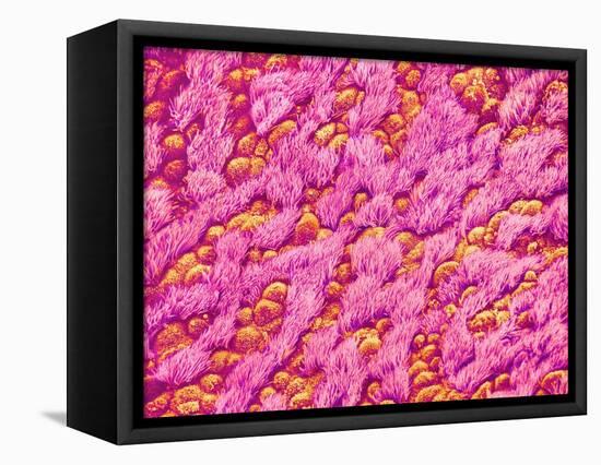 Bronchus of a Rat-Micro Discovery-Framed Stretched Canvas