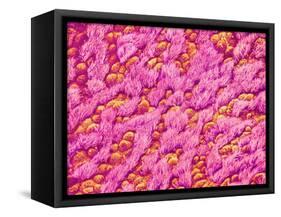 Bronchus of a Rat-Micro Discovery-Framed Stretched Canvas