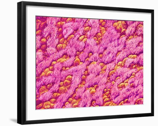 Bronchus of a Rat-Micro Discovery-Framed Photographic Print