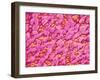 Bronchus of a Rat-Micro Discovery-Framed Photographic Print