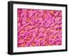 Bronchus of a Rat-Micro Discovery-Framed Photographic Print