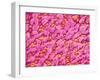 Bronchus of a Rat-Micro Discovery-Framed Photographic Print