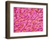 Bronchus of a Rat-Micro Discovery-Framed Photographic Print