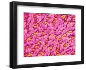 Bronchus of a Rat-Micro Discovery-Framed Photographic Print