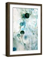 Brown Mould Fungus, Light Micrograph-Dr. Keith Wheeler-Framed Photographic Print
