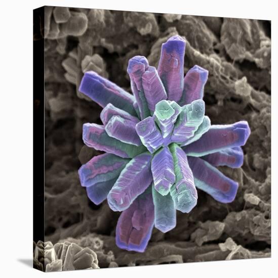Calcium Phosphate Crystal, SEM-Steve Gschmeissner-Stretched Canvas