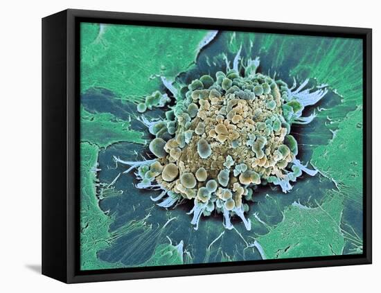 Cancer Cell Apoptosis, SEM-Steve Gschmeissner-Framed Stretched Canvas