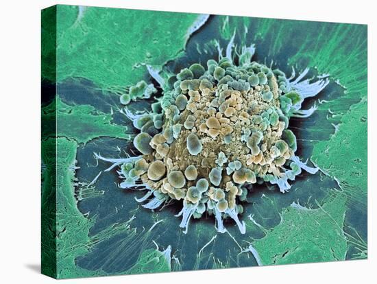Cancer Cell Apoptosis, SEM-Steve Gschmeissner-Stretched Canvas