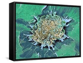 Cancer Cell Apoptosis, SEM-Steve Gschmeissner-Framed Stretched Canvas
