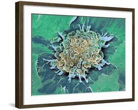 Cancer Cell Apoptosis, SEM-Steve Gschmeissner-Framed Photographic Print