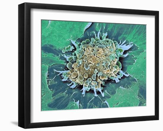 Cancer Cell Apoptosis, SEM-Steve Gschmeissner-Framed Photographic Print