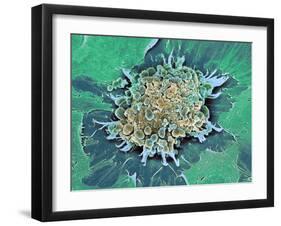 Cancer Cell Apoptosis, SEM-Steve Gschmeissner-Framed Photographic Print