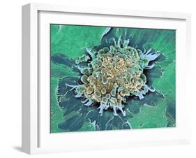 Cancer Cell Apoptosis, SEM-Steve Gschmeissner-Framed Photographic Print