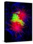 Cancer Cell Division-Dr. Paul Andrews-Stretched Canvas