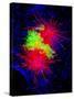 Cancer Cell Division-Dr. Paul Andrews-Stretched Canvas
