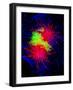 Cancer Cell Division-Dr. Paul Andrews-Framed Photographic Print