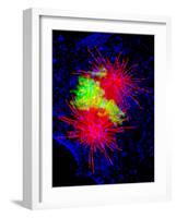 Cancer Cell Division-Dr. Paul Andrews-Framed Photographic Print