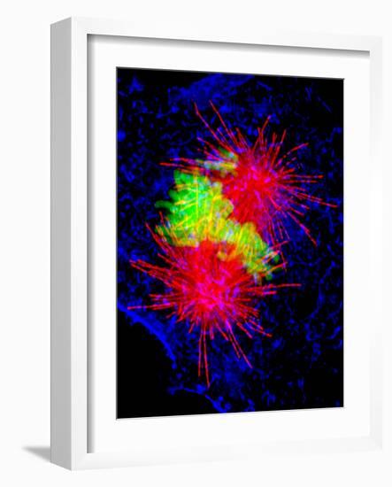 Cancer Cell Division-Dr. Paul Andrews-Framed Photographic Print