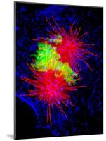 Cancer Cell Division-Dr. Paul Andrews-Mounted Photographic Print