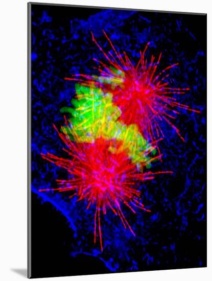 Cancer Cell Division-Dr. Paul Andrews-Mounted Photographic Print
