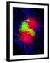Cancer Cell Division-Dr. Paul Andrews-Framed Photographic Print