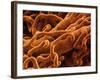 Capillaries, SEM-S. Cinti-Framed Photographic Print