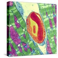 Cardiac Muscle And Capillary, TEM-Thomas Deerinck-Stretched Canvas